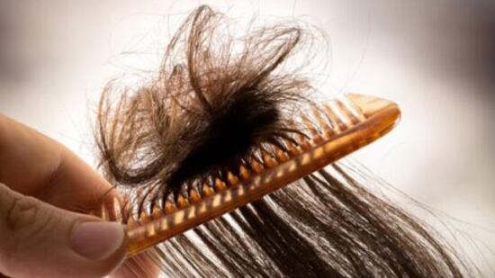 تعد حالة غريبة ونادرة: ماذا تعرف عن متلازمة الشعر غير القابل للتمشيط؟